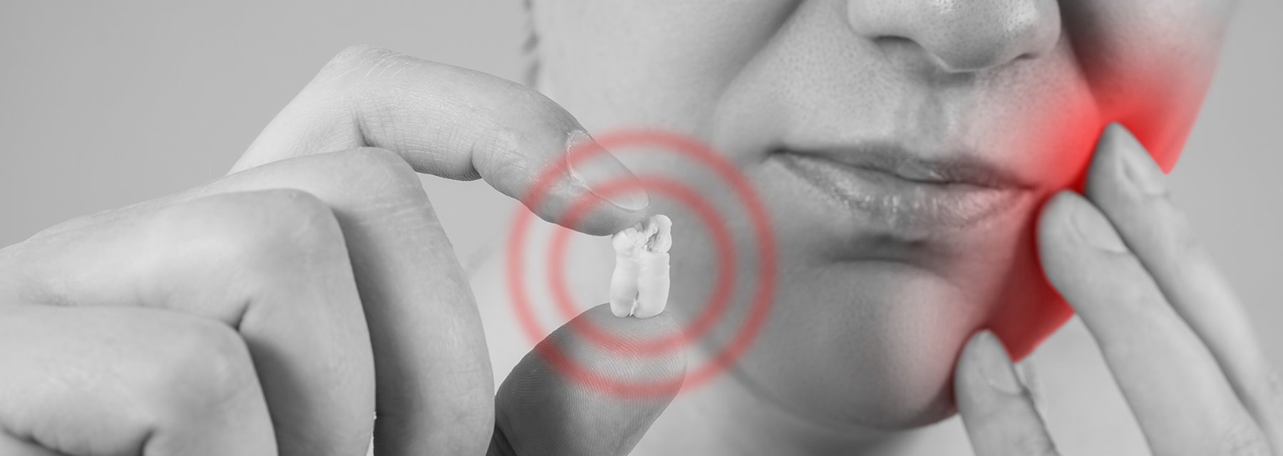 Wisdom Teeth Treatment for Oral and Implant Surgery